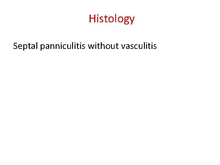 Histology Septal panniculitis without vasculitis 