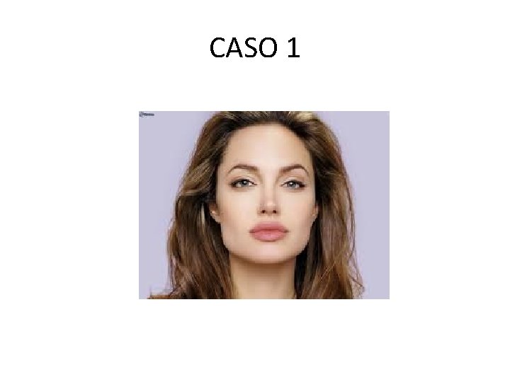 CASO 1 