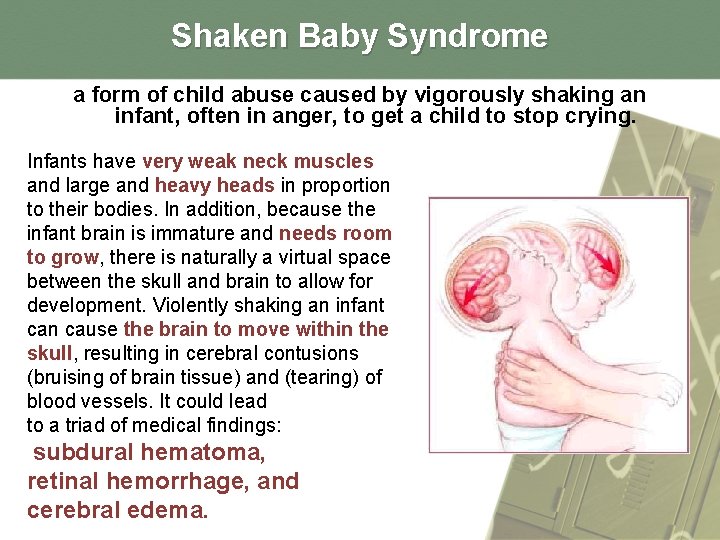 Shaken Baby Syndrome a form of child abuse caused by vigorously shaking an infant,