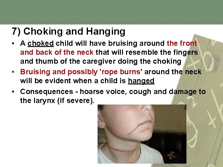 7) Choking and Hanging • A choked child will have bruising around the front