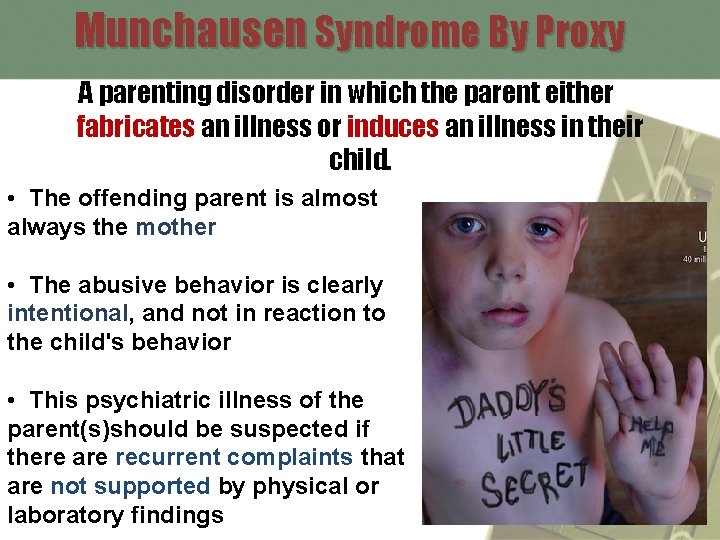 Munchausen Syndrome By Proxy A parenting disorder in which the parent either fabricates an