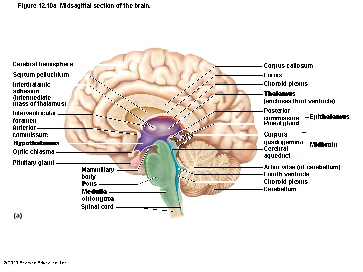 Figure 12. 10 a Midsagittal section of the brain. Cerebral hemisphere Corpus callosum Fornix