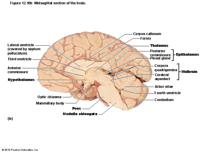 Figure 12. 10 b Midsagittal section of the brain. Corpus callosum Fornix Lateral ventricle