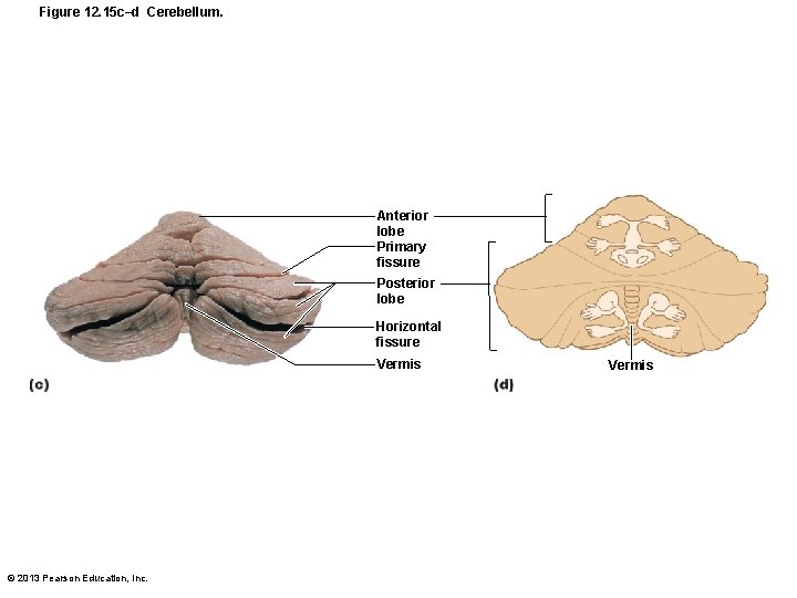 Figure 12. 15 c–d Cerebellum. Anterior lobe Primary fissure Posterior lobe Horizontal fissure Vermis