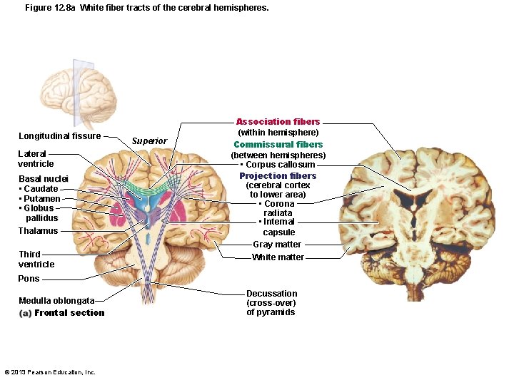 Figure 12. 8 a White fiber tracts of the cerebral hemispheres. Longitudinal fissure Lateral