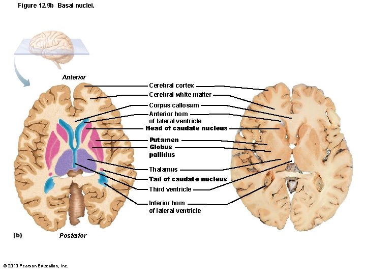 Figure 12. 9 b Basal nuclei. Anterior Cerebral cortex Cerebral white matter Corpus callosum