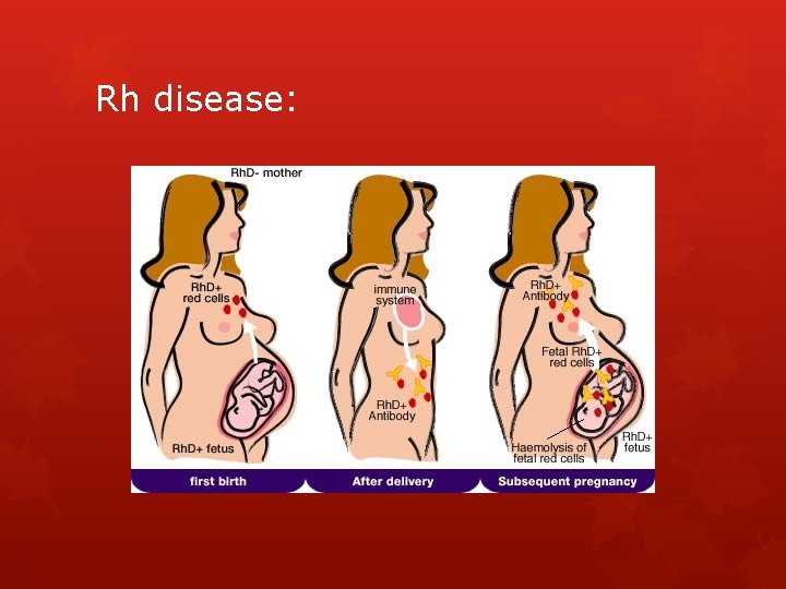 Rh disease: 