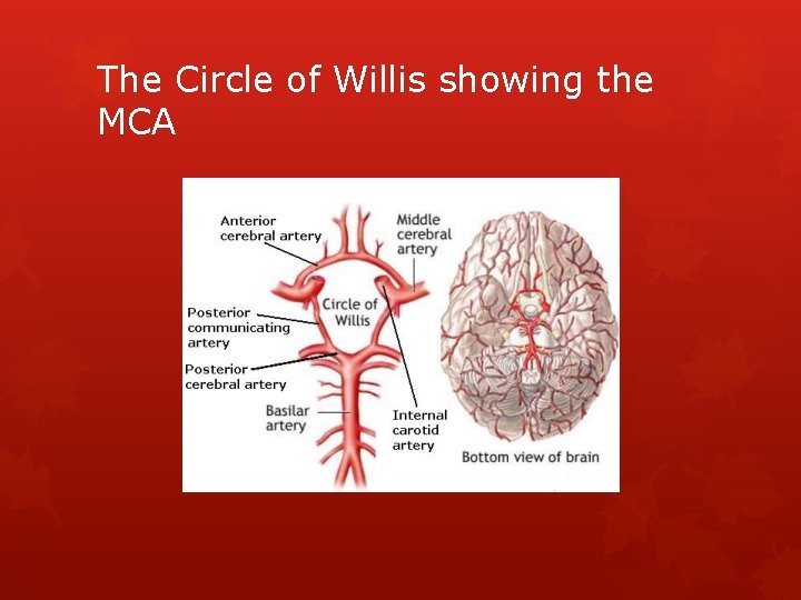 The Circle of Willis showing the MCA 