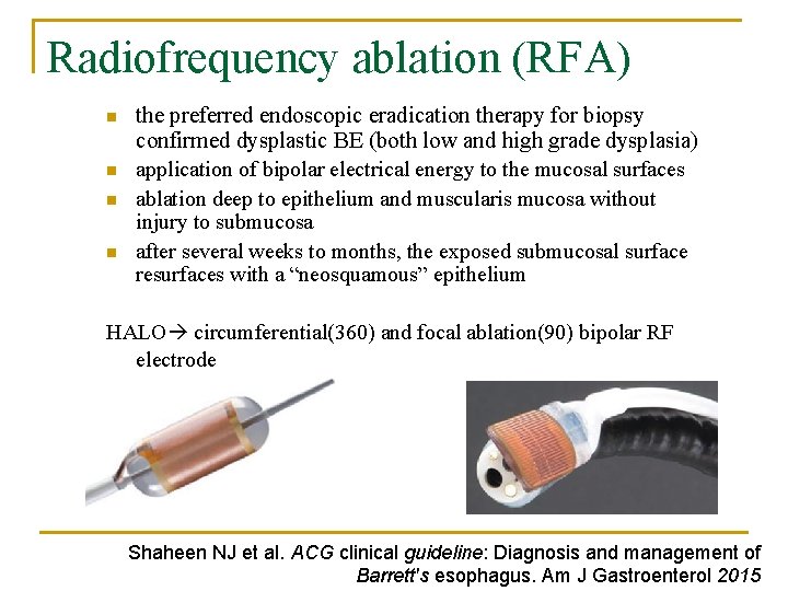 Radiofrequency ablation (RFA) n n the preferred endoscopic eradication therapy for biopsy confirmed dysplastic