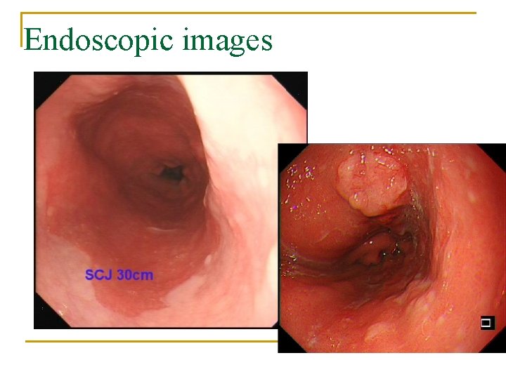 Endoscopic images 