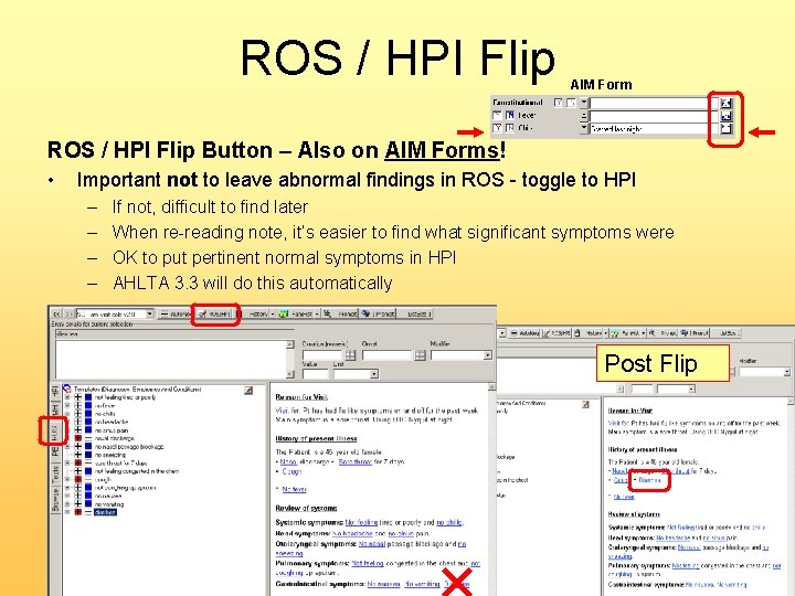 ROS / HPI Flip AIM Form ROS / HPI Flip Button – Also on