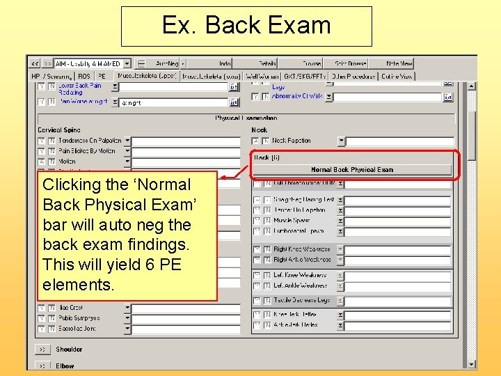 Ex. Back Exam Clicking the ‘Normal Back Physical Exam’ bar will auto neg the