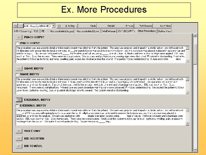 Ex. More Procedures 