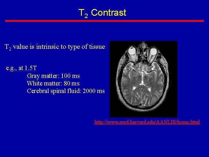 T 2 Contrast T 2 value is intrinsic to type of tissue e. g.