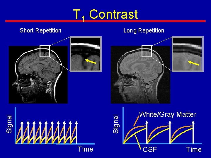 T 1 Contrast Signal Long Repetition Signal Short Repetition Time White/Gray Matter CSF Time