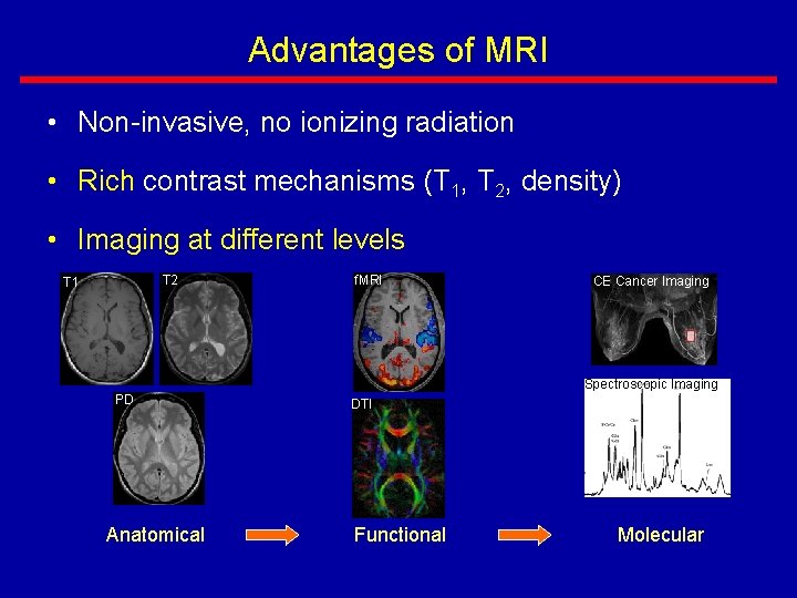 Advantages of MRI • Non-invasive, no ionizing radiation • Rich contrast mechanisms (T 1,