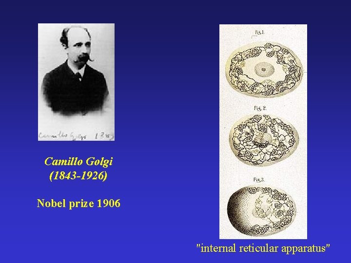 Camillo Golgi (1843 -1926) Nobel prize 1906 "internal reticular apparatus" 