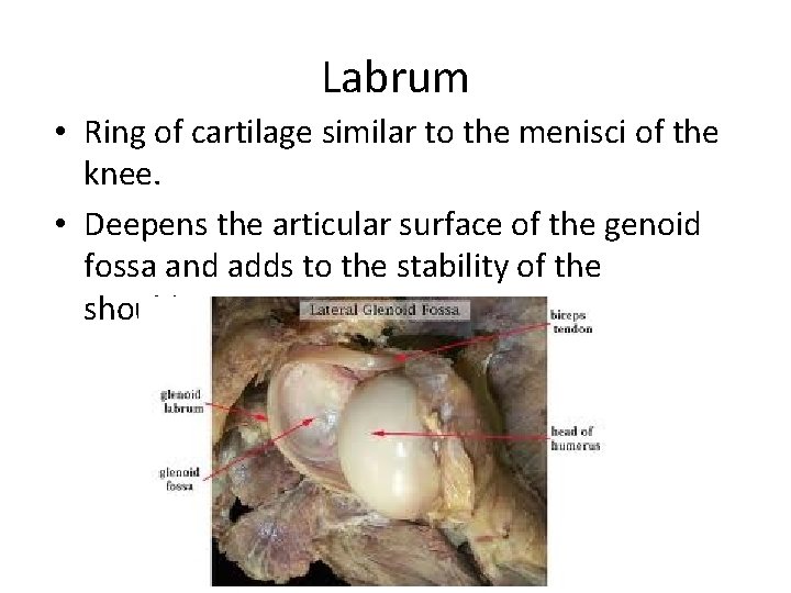 Labrum • Ring of cartilage similar to the menisci of the knee. • Deepens