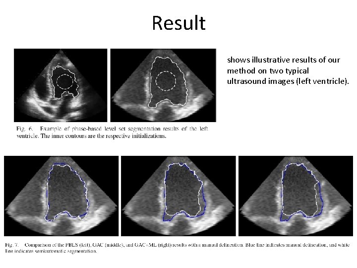 Result shows illustrative results of our method on two typical ultrasound images (left ventricle).