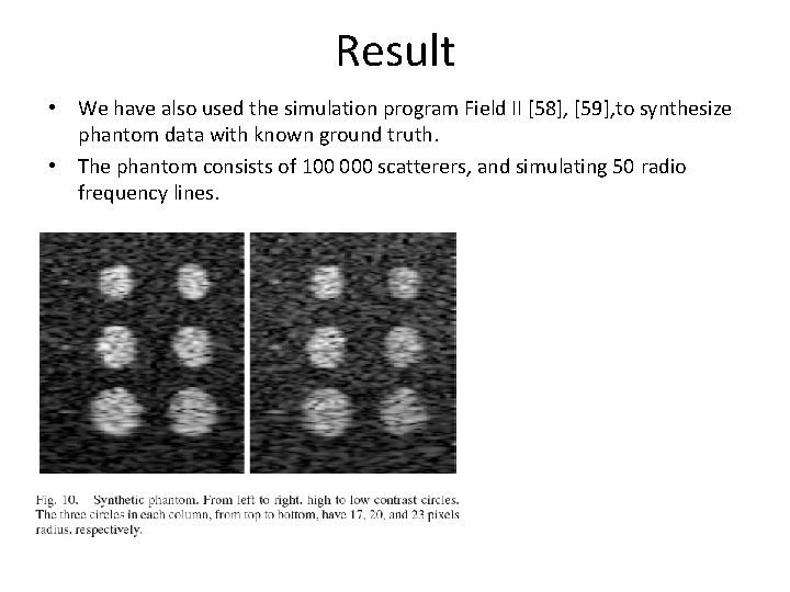 Result • We have also used the simulation program Field II [58], [59], to