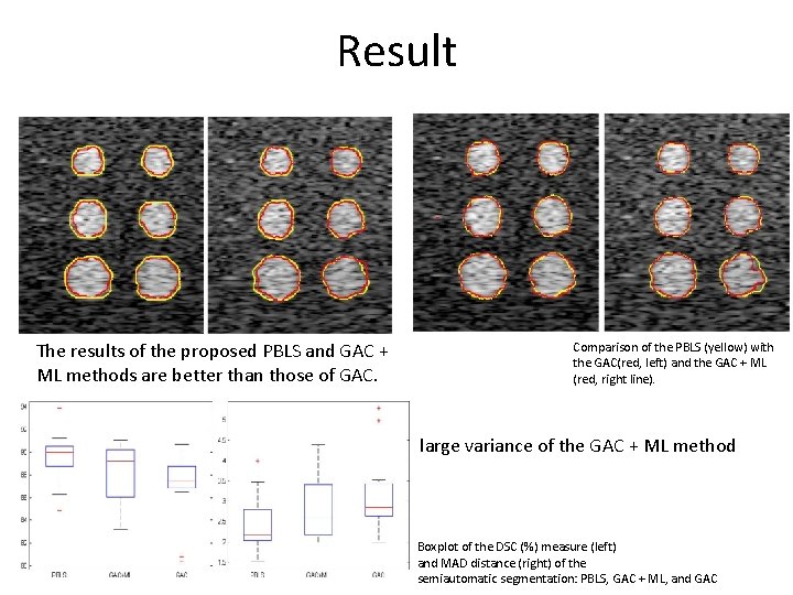 Result The results of the proposed PBLS and GAC + ML methods are better