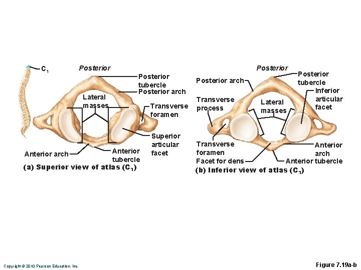 C 1 Posterior Lateral masses Posterior tubercle Posterior arch Anterior arch tubercle (a) Superior