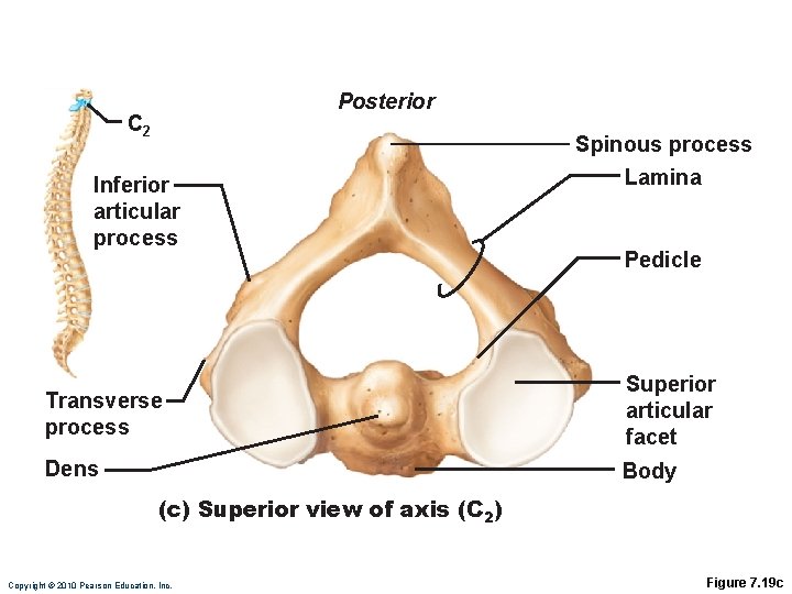 Posterior C 2 Inferior articular process Spinous process Lamina Pedicle Transverse process Superior articular