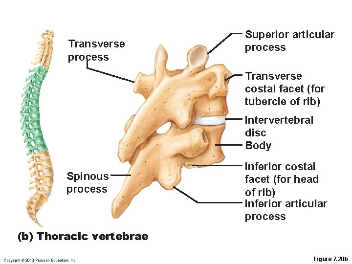 Transverse process Superior articular process Transverse costal facet (for tubercle of rib) Intervertebral disc