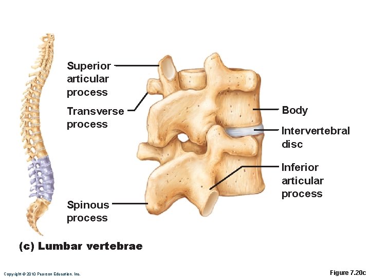 Superior articular process Transverse process Spinous process Body Intervertebral disc Inferior articular process (c)