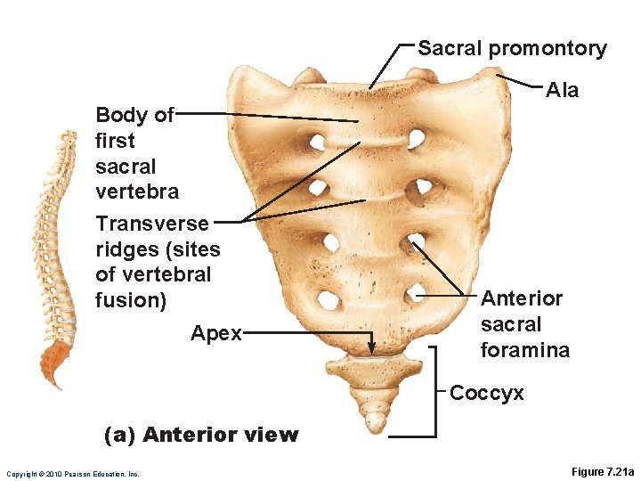 Sacral promontory Ala Body of first sacral vertebra Transverse ridges (sites of vertebral fusion)