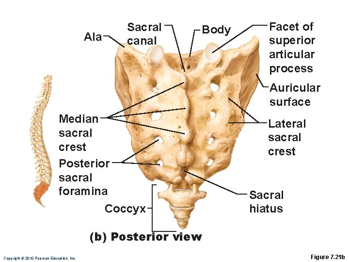 Ala Sacral canal Body Facet of superior articular process Auricular surface Median sacral crest