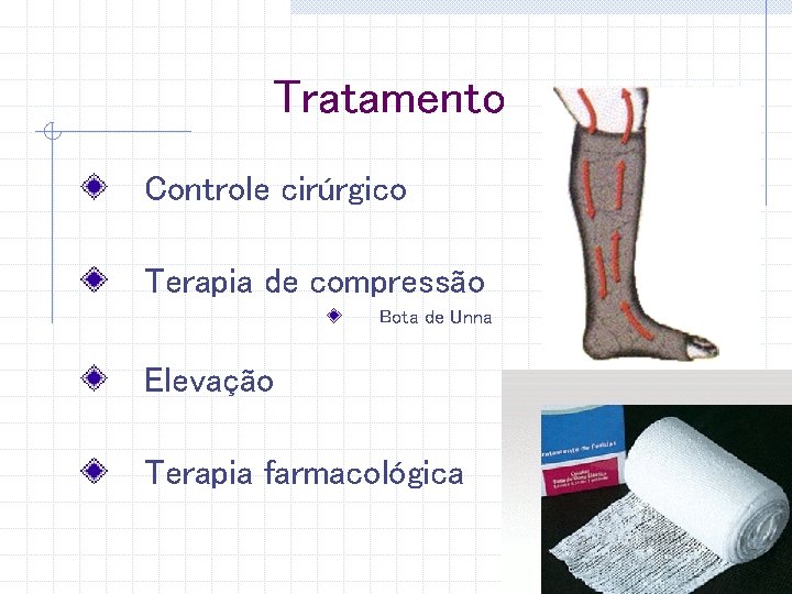 Tratamento Controle cirúrgico Terapia de compressão Bota de Unna Elevação Terapia farmacológica 