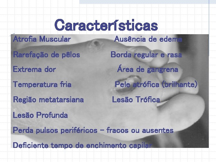 Características Atrofia Muscular Rarefação de pêlos Ausência de edema Borda regular e rasa Extrema