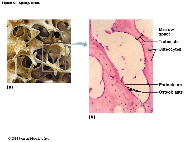 Figure 6. 9 Spongy bone. Marrow space Trabecula Osteocytes Endosteum Osteoblasts © 2014 Pearson