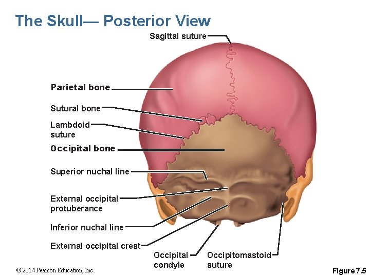 The Skull— Posterior View Sagittal suture Parietal bone Sutural bone Lambdoid suture Occipital bone