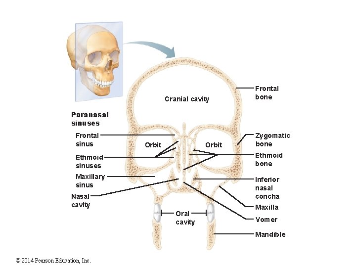 Cranial cavity Frontal bone Paranasal sinuses Frontal sinus Orbit Zygomatic bone Ethmoid sinuses Ethmoid