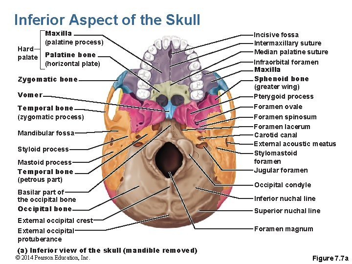 Inferior Aspect of the Skull Hard palate Maxilla (palatine process) Palatine bone (horizontal plate)