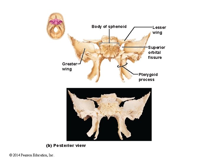 Body of sphenoid Lesser wing Superior orbital fissure Greater wing Pterygoid process (b) Posterior