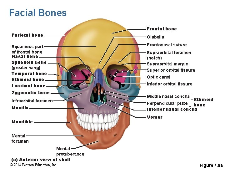 Facial Bones Frontal bone Parietal bone Squamous part of frontal bone Nasal bone Sphenoid