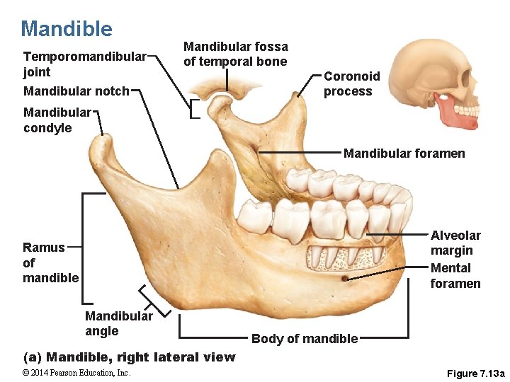 Mandible Temporomandibular joint Mandibular notch Mandibular fossa of temporal bone Coronoid process Mandibular condyle