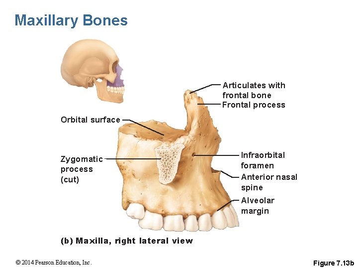 Maxillary Bones Articulates with frontal bone Frontal process Orbital surface Zygomatic process (cut) Infraorbital