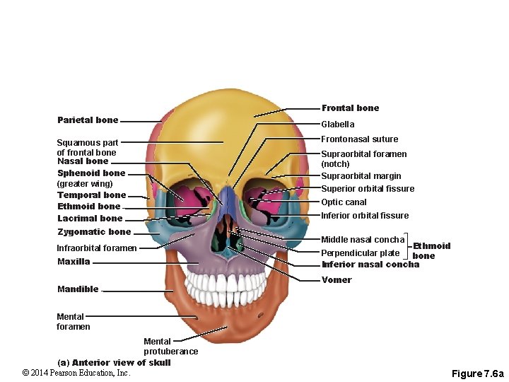 Frontal bone Parietal bone Squamous part of frontal bone Nasal bone Sphenoid bone (greater