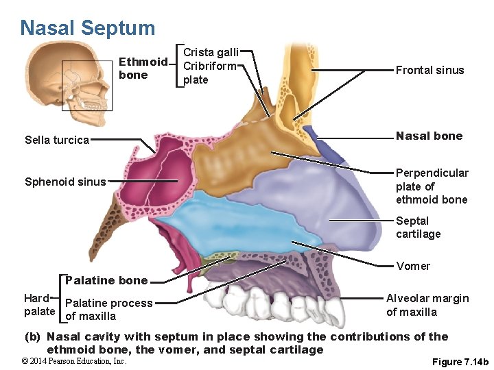 Nasal Septum Ethmoid bone Crista galli Cribriform plate Frontal sinus Sella turcica Nasal bone