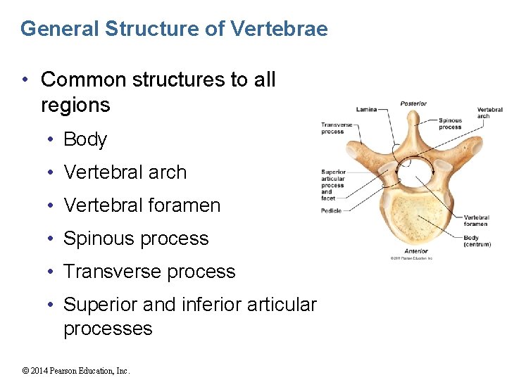 General Structure of Vertebrae • Common structures to all regions • Body • Vertebral