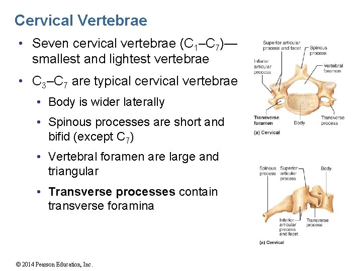 Cervical Vertebrae • Seven cervical vertebrae (C 1–C 7)— smallest and lightest vertebrae •