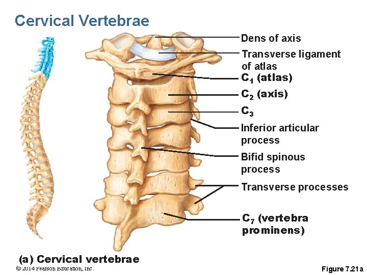 Cervical Vertebrae Dens of axis Transverse ligament of atlas C 1 (atlas) C 2