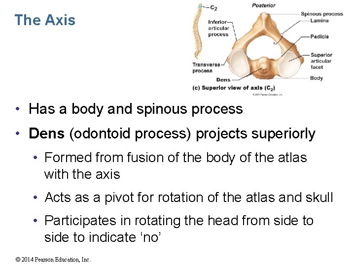 The Axis • Has a body and spinous process • Dens (odontoid process) projects