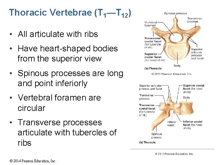 Thoracic Vertebrae (T 1—T 12) • All articulate with ribs • Have heart-shaped bodies
