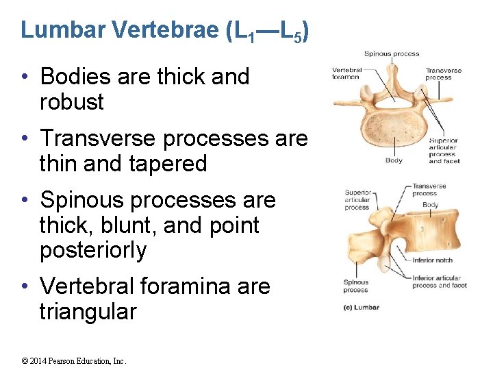 Lumbar Vertebrae (L 1—L 5) • Bodies are thick and robust • Transverse processes