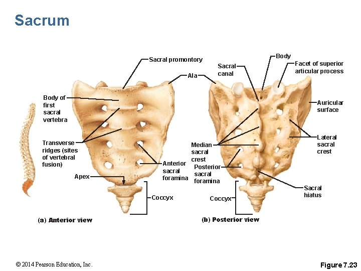 Sacrum Body Sacral promontory Ala Sacral canal Body of first sacral vertebra Facet of